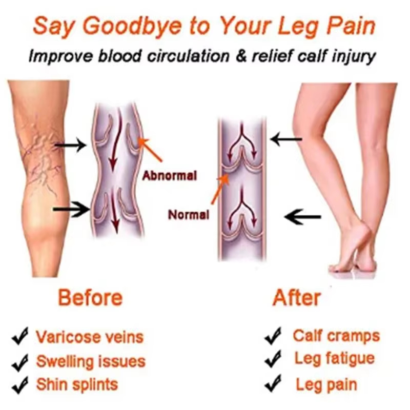 Women Compression Socks Slimmi - Compression Sleeve Calf recension och pris